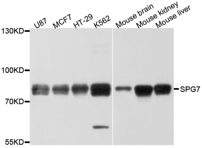 SPG7 Antibody in Western Blot (WB)