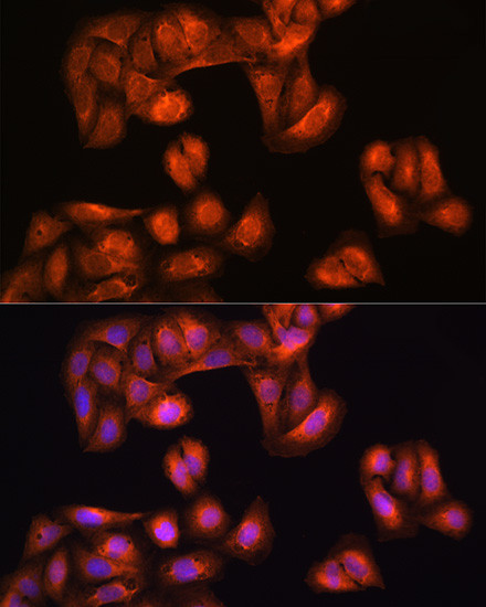 PHGDH Antibody in Immunocytochemistry (ICC/IF)