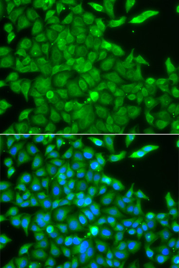 CK1 gamma-2 Antibody in Immunocytochemistry (ICC/IF)