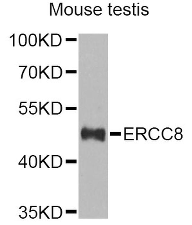 ERCC8 Antibody in Western Blot (WB)