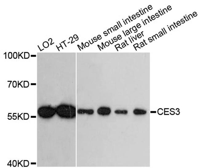 CES3 Antibody in Western Blot (WB)