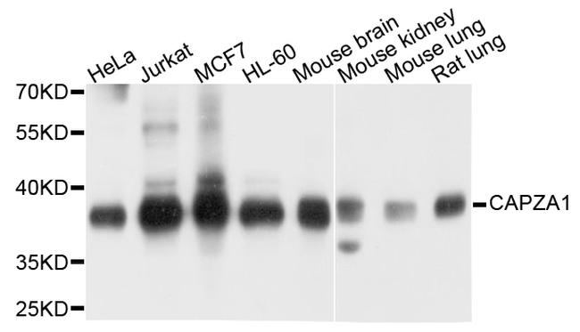 CAPZA1 Antibody in Western Blot (WB)