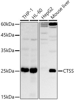 Cathepsin S Antibody in Western Blot (WB)