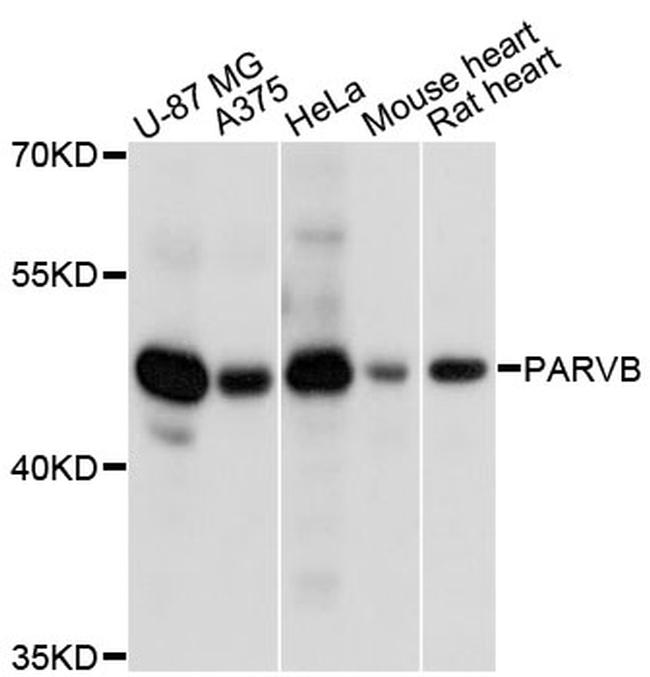 PARVB Antibody in Western Blot (WB)