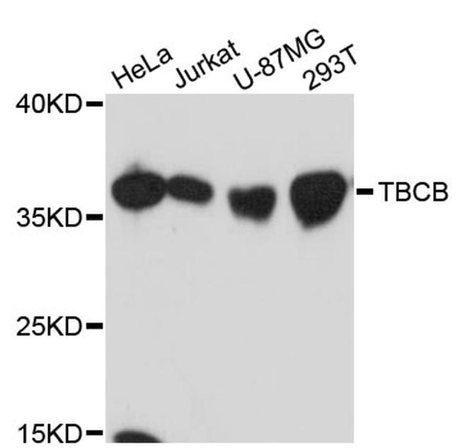 CKAP1 Antibody in Western Blot (WB)