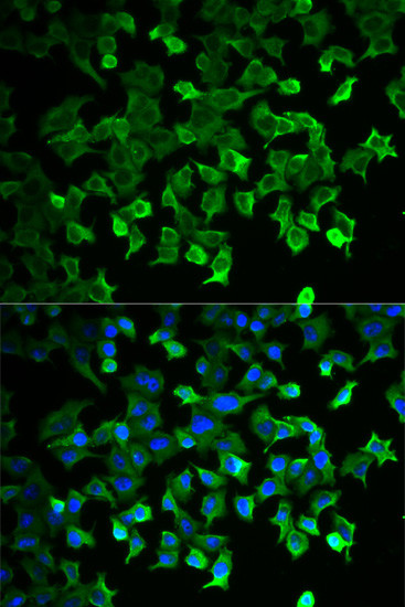 HSPA1A Antibody in Immunocytochemistry (ICC/IF)