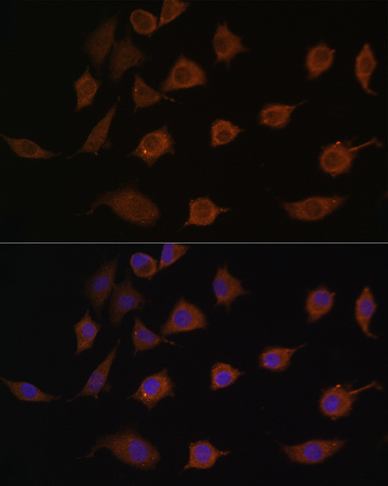 LSM1 Antibody in Immunocytochemistry (ICC/IF)