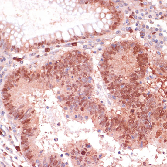 S100P Antibody in Immunohistochemistry (Paraffin) (IHC (P))