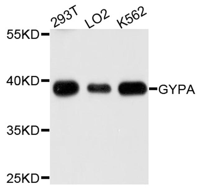 CD235a Antibody in Western Blot (WB)