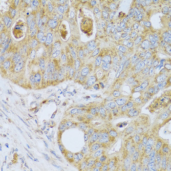 PSG1 Antibody in Immunohistochemistry (Paraffin) (IHC (P))