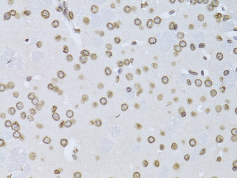 Lamin B2 Antibody in Immunohistochemistry (Paraffin) (IHC (P))