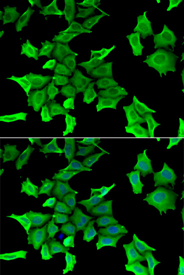 HAI-2 Antibody in Immunocytochemistry (ICC/IF)