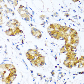 WFDC2 Antibody in Immunohistochemistry (Paraffin) (IHC (P))