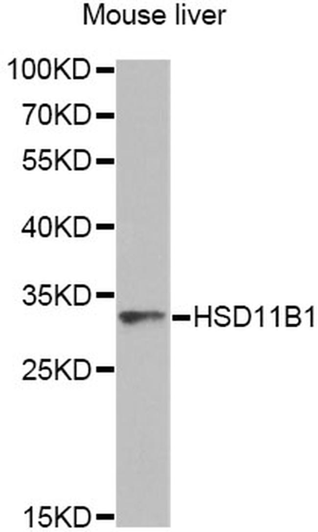 HSD11B1 Antibody in Western Blot (WB)