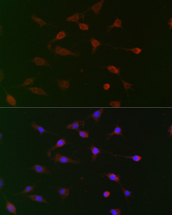 Cdc34 Antibody in Immunocytochemistry (ICC/IF)