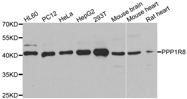 PPP1R8 Antibody in Western Blot (WB)