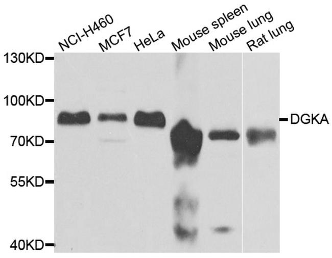 DGKA Antibody in Western Blot (WB)