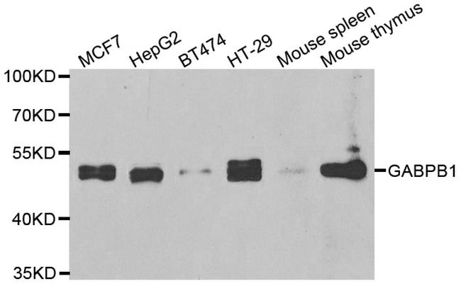 GABPB1 Antibody in Western Blot (WB)