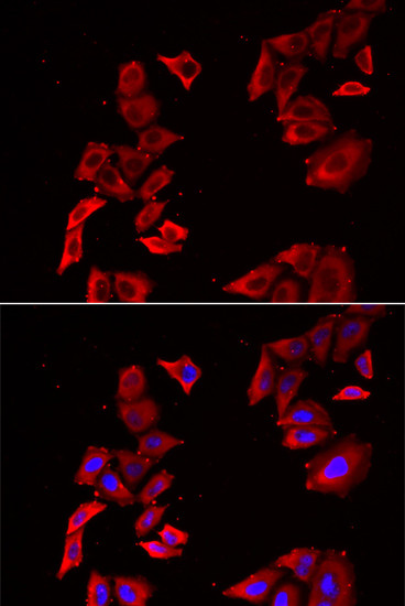 MEK5 Antibody in Immunocytochemistry (ICC/IF)