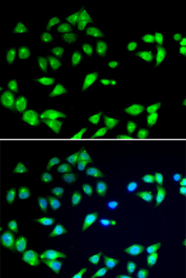 ARFGAP1 Antibody in Immunocytochemistry (ICC/IF)