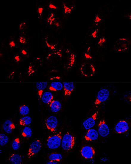 GOLPH2 Antibody in Immunocytochemistry (ICC/IF)