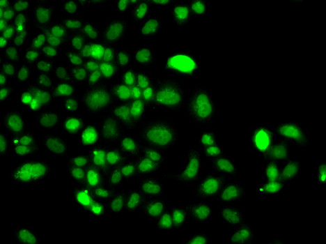 PIP4K2A Antibody in Immunocytochemistry (ICC/IF)