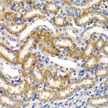 ZFAND3 Antibody in Immunohistochemistry (Paraffin) (IHC (P))