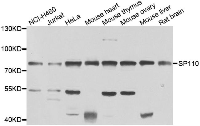 SP110 Antibody in Western Blot (WB)