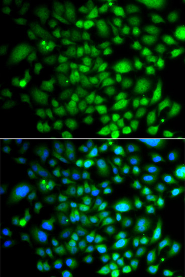 BRK Antibody in Immunocytochemistry (ICC/IF)