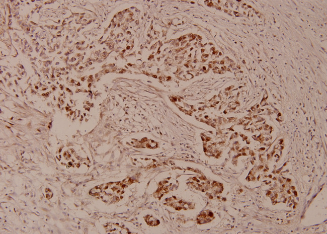 ZNF329 Antibody in Immunohistochemistry (Paraffin) (IHC (P))