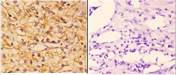 PIK3CG Antibody in Immunohistochemistry (Paraffin) (IHC (P))