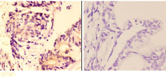 AMPK beta-1 Antibody in Immunohistochemistry (Paraffin) (IHC (P))