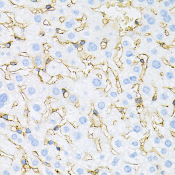 INSR Antibody in Immunohistochemistry (Paraffin) (IHC (P))