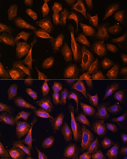 alpha-II Spectrin Antibody in Immunocytochemistry (ICC/IF)