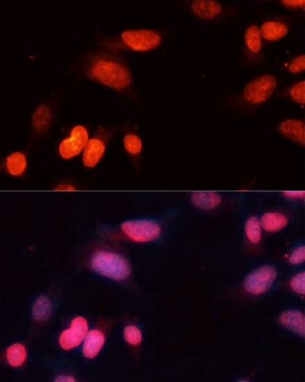 SIRT1 Antibody in Immunocytochemistry (ICC/IF)