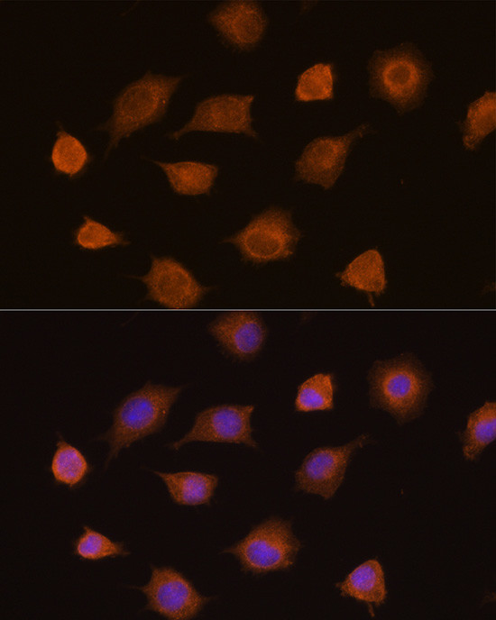 PKM2 Antibody in Immunocytochemistry (ICC/IF)