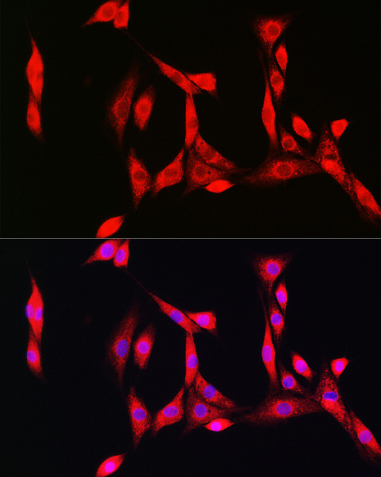 SOD1 Antibody in Immunocytochemistry (ICC/IF)
