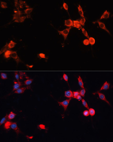 HSP70 Antibody in Immunocytochemistry (ICC/IF)