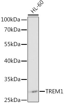 TREM-1 Antibody in Western Blot (WB)