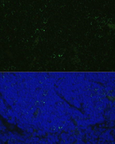 CD4 Antibody in Immunocytochemistry (ICC/IF)