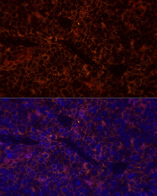 CD45 Antibody in Immunocytochemistry (ICC/IF)