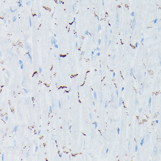 N-cadherin Antibody in Immunohistochemistry (Paraffin) (IHC (P))