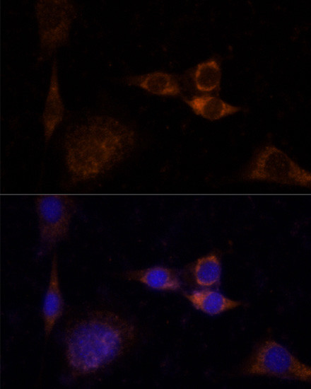 PKC delta Antibody in Immunocytochemistry (ICC/IF)