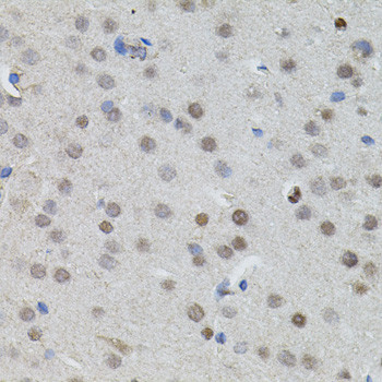 n-Myc Antibody in Immunohistochemistry (Paraffin) (IHC (P))