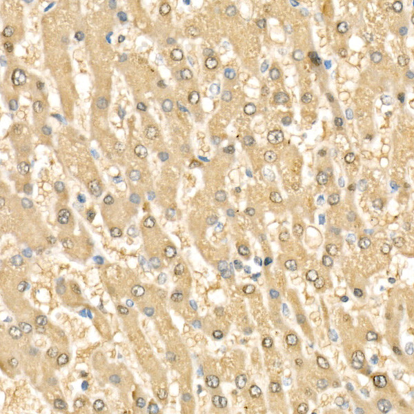 RelB Antibody in Immunohistochemistry (Paraffin) (IHC (P))