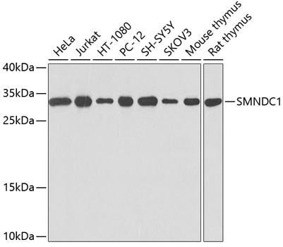 SMNDC1 Antibody in Western Blot (WB)