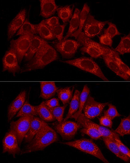 Endothelin 1 Antibody in Immunocytochemistry (ICC/IF)