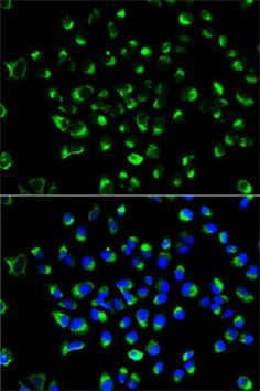 PDI Antibody in Immunocytochemistry (ICC/IF)