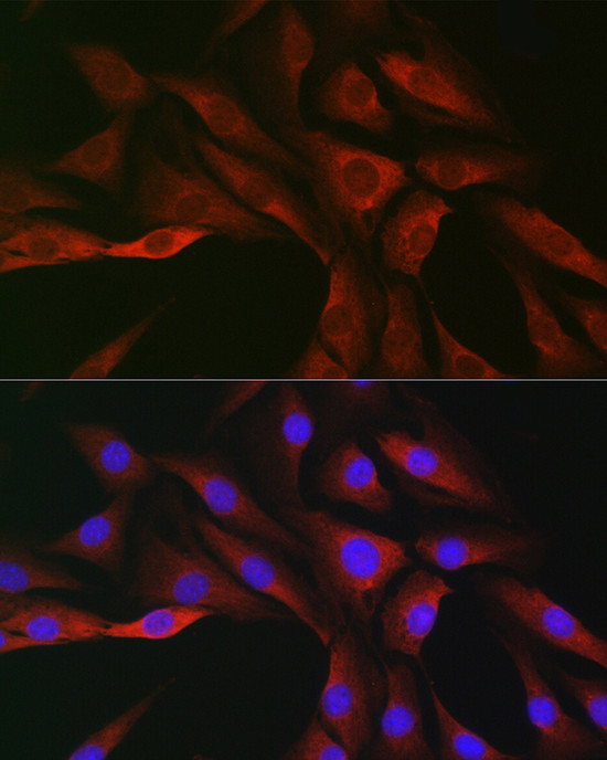 SOCS3 Antibody in Immunocytochemistry (ICC/IF)