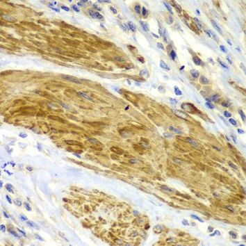 CDK6 Antibody in Immunohistochemistry (Paraffin) (IHC (P))